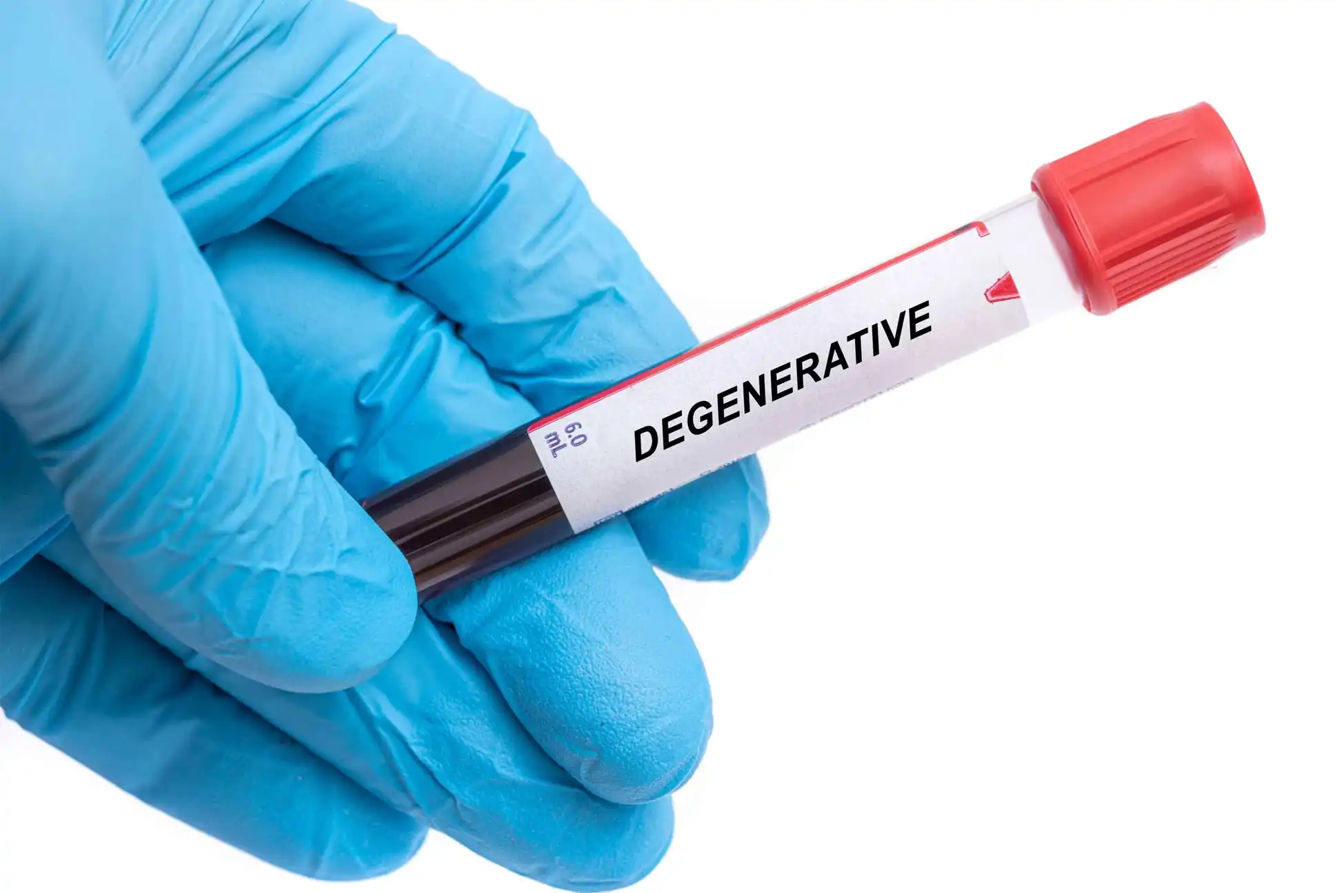 Degenerative Diseases Degenerative Diseases